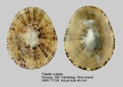 Patella vulgata